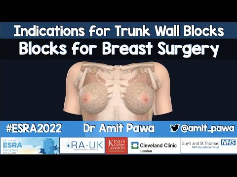 Blocks for Breast Surgery - ESRA2022