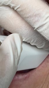 Now for prototype with shining 3D! Artisandentalusa Josh Townsend | Luke Kahng