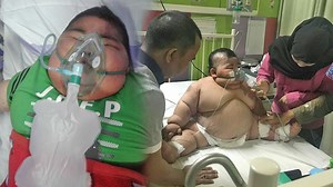 Viral Balita 4 Tahun di Kalsel Sakit Komplikasi karena Obesitas, Dirawat di RS dan Butuh Bantuan - Tribun Video