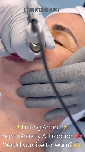 ✨DERMOTECHNOLOGY Signature Protocol 🙌⚡️The Ultimate Fusion✨ With Geraldine, discover our latest innovation: 🙌One silver conductive glove ⚡️ one face roller 💧two hands, two energies, one powerful transformation. On one side, we lift, sculpt, and model the skin. On the other, we electro-channel natural bioactives deep into the skin to renew and energize from within. We are fighting 🥊gravity’s pull, lifting the skin and sculpting it ⚡️all at the same time. It’s a precise, powerful treatment whe