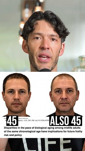 Mike Mutzel, MS on Instagram: "Your facial age speaks volumes about your diet, exercise, lifestyle and mindset, a new 45 year study finds. Frequently forgetting keys, wallet, having a hard time concentrating and have negative perceptions of your age is also linked with accelerated biological aging, the scientists found. A deep dive on this episode is posting on my YouTube channel and podcast tomorrow. These results are really revealing and actionable. "