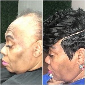 171K views · 492 reactions | Woman with Alopecia gets the most amazing hair transformation! | MetDaan Tips | Facebook