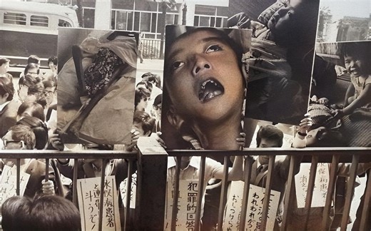 1956年，日本水俣病真实录像，5万只猫跳海自杀，人体畸形犹如贞子