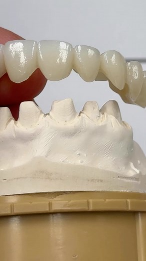 All splint! | CEO Luke Kahng