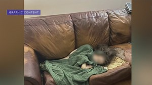 Coroner wants graphic photos of woman ‘melted’ to sofa shown
