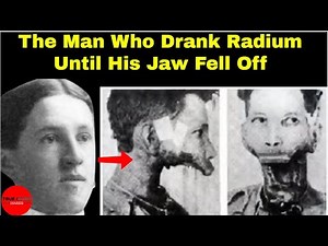 The Man Who Drank Radium Until His Jaw Fell Off | Eben Byers | True Crime Diaries