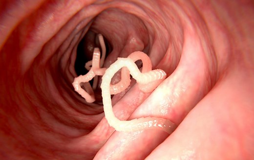 Ver solitaire ou ténia : comment le reconnaître et s’en débarrasser ?