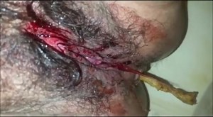 Periods and poop closeup