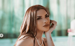 Así lucía el rostro de Kimberly Loaiza antes de operarse en Colombia