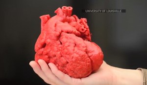 Viitorul transplantului de organe? O inimă umană ar putea fi obţinută la o imprimantă 3D (VIDEO)