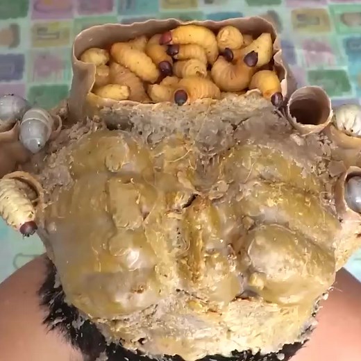 Itchy Dry Scalp Dandruff Removal Satisfying Maggot Worms Biggest Hole​ #2075 Part 1 | Help remove ticks