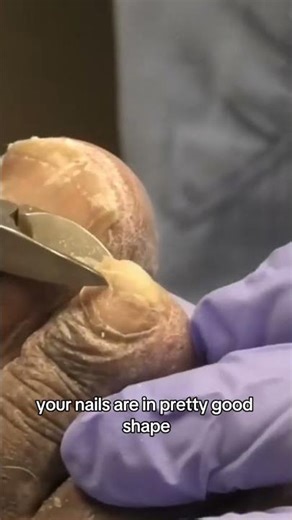 “When I Trimmed Them… They Were WAY Bigger!” 👀 The Benefits of Pedicures