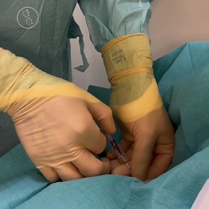 The most advanced way to attack cancer, PEF and intratumoral immunotherapy. https://williamscancerinstitute.com #cancer #stage4cancer #cancerpatient #cancerpatientsupport #cancercenter #cancercentersofamerica #cancercare #cancerfighter | Williams Cancer Institute