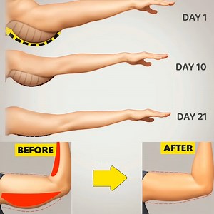 31K views · 453 reactions | Workout for toned and beautiful arms. | DEMIC | Facebook