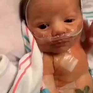 Ein frühgeborenes Baby atmet mithilfe einer Nasenkanüle – einem Gerät zur kurzzeitigen oder dauerhaften Sauerstoffzufuhr in die Atemwege. Sie wird eingesetzt, wenn Atemnot, Sauerstoffmangel oder eine unreife Lungenfunktion vorliegen. | Anatomie