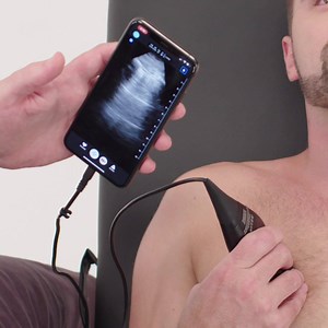 One probe, whole body ultrasound, starting under $2k. | Butterfly Network, Inc