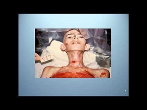 Nutrient Delivery: Enteral Nutrition Part I