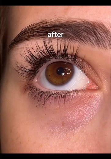 Achieve Your Dream Lashes with Lash Serum Results