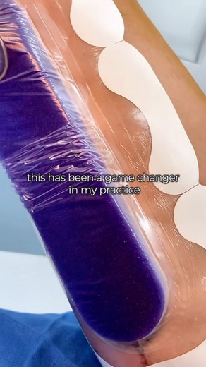 MEDIAL THIGH LIFT [Sound ON] 🦵🏼 ✨ Our 41-year-old patient wanted to remove excess skin from her thighs. She underwent a medial thigh lift, a procedure that tightens and tones the inner thigh by removing skin and fat. For optimal results, she also opted for Prevena Incision Therapy. ✨ There are different types of thigh lifts, including inner thigh lifts, bilateral thigh lifts, and medial thigh lifts. After a thorough consultation, this patient was determined to be an ideal candidate for the med