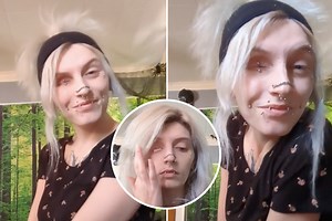 Woman Answers Burning Question About Her Radical ‘Eyelid Piercing’