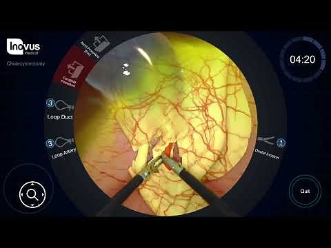 How to perform laparoscopic cholecystectomy training using the LapAR 10x speed