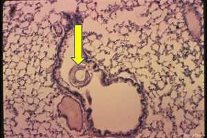 Protect your pigs from verminous pneumonia