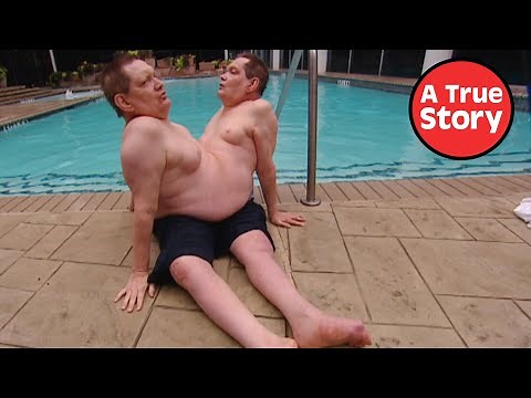 The World's Oldest Conjoined Twins: The Complete Documentary Series | A True Story
