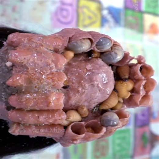 Remove Biggest Lice With Worms On Scalp 324 | Jannat Mirza