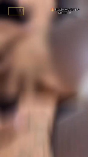 ⚠️ Tap here for an answer! ✅ Spoiler alert 4th digit PIP joint dislocation There’s an obvious deformity of the 4th finger of this patient’s left hand. Looking closer you’ll see it’s | Dr. Matt Barrett