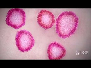 Sarasota Memorial Hospital working to find cure for COVID-19