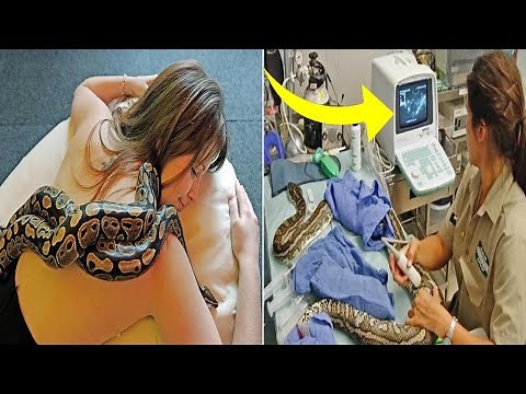Woman Sleeps With Snake Every Night, Until Doctor Shows Her What's Inside