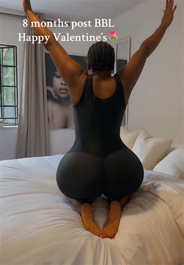 8 Months Post BBL Journey: A Valentine’s Reflection