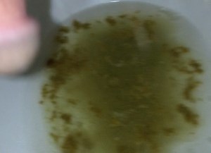 Last Diarrhea of 2018