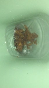 runny shit - video 9