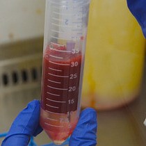 Video: Generation of Integration-free Induced Pluripotent Stem Cells from Human Peripheral Blood Mononuclear Cells Using Episomal Vectors