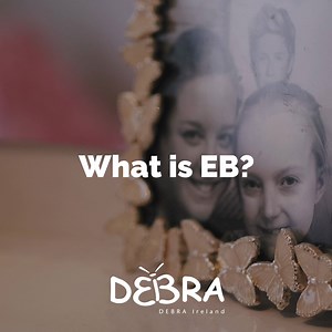 Brave Claudia (14) was born with epidermolysis bullosa. EB is the worst condition you've probably never heard of. Text BUTTERFLY to 50300 to donate €4 to DEBRA Ireland. (Text costs €4. DEBRA Ireland will receive a minimum of €3.60. Service Provider: LIKECHARITY. Helpline: 076 6805278.) | Debra Ireland - The Butterfly Skin Charity