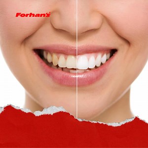 Extraordinary smiles need extra care! Forhan’s Extra Care Toothpaste gives you extra strong, white teeth with complete dental protection—something ordinary toothpaste just can’t match. Order now on Daraz: https://www.daraz.pk/shop/forhans #ForhansPK #ForhansToothpaste #ProtectYourTeeth #SmileBrighter #StrongTeeth #ExtraCare #Forhans #ForhansPakistan | Forhan's - Pakistan | Facebook