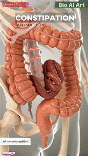 Constipation Animation | | Digestive System | Human Anatomy | Bio AI Art | 15