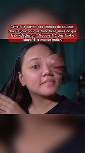 28K views · 262 reactions | Cette fille portait des lentilles de couleur chaque jour pour se faire belle, mais ce que les médecins ont découvert 5 plus tard a stupéfié le monde entier. . . #apprendresurtiktok #histoirevrai #makeup #beaute #lentilles #portrait #couleur #médecin #monde #attente #mystère #histoire #truestory #storytime #fyp #foryou #france #usa | Suspense et étrange | Facebook