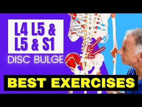 L4 L5 & L5 S1 Disc Bulge, Best Exercises Rehab For Relief