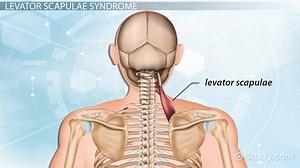 Levator Scapulae Syndrome: Causes, Symptoms & Treatment - Video | Study.com