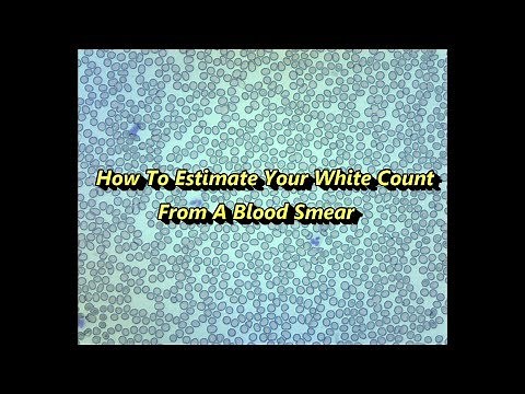 How to Estimate your White Blood Cell Count from a Blood Smear