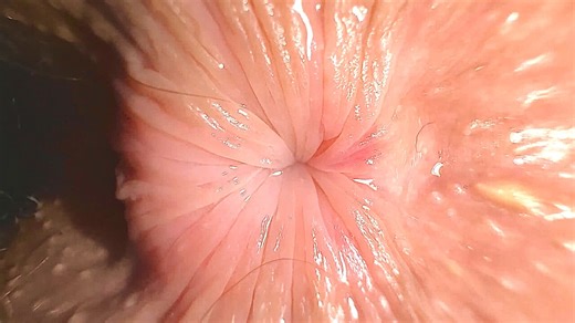 EXTREME CLOSE UP: Teenage butthole is trying to kiss you trough the screen of your IPhone