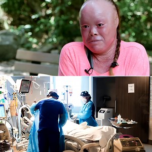 🚨The Tragic Case of a Girl Whose Body Is Changing Beyond Recognition 🚨Click Now👇😮 https://rednew.goodstorie.info/the-tragic-case-of-a-girl-whose-body-is-changing-beyond-recognition/ Doctors are baffled by a young woman whose body has begun to twist and change in ways science can barely explain. Once healthy and full of life, she now faces a terrifying condition that warps her appearance day by day. Friends describe her transformation as “like watching someone you love fade into a stranger.” 