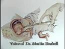 Abortion - This is a Dilation and Extraction Abortion