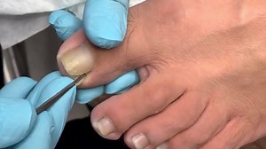 Knife cutting professional Toenails 👣 Link order : https://bit.ly/3j7MsjL 👣 | Emma Manicure & Pedicure