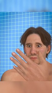 can you reattach a Severed finger . . . . . . . . . . . #LiveSaver #Bestvideo #whatif #fingersave #lifesaving #education #fypシ゚ #virals #newvideo #fbshorts #fyp | Deep Access