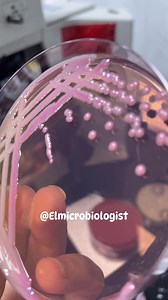 30K views · 454 reactions | Lactose fermenter IMViC test - -++ Gauss?? @Mariam_Microverse #Elmicrobiologist | Elmicrobiologist | Facebook