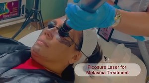 18 reactions · 5 comments | Celebrate flawless skin with PicoSure Laser - your ultimate solution for Melasma Treatment!  Watch as our advanced technology precisely targets and gently breaks down pigmentation, leaving behind a radiant and even complexion. Say goodbye to melasma and hello to confidence! ✨ #PicoSureMagic #MelasmaTreatment #FlawlessSkin | Skin And Shape Aesthetic Clinic-Pagadian | Facebook