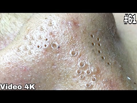 #61 Satisfy Relaxation with Best Videos of B'Young Spa 2 ‪@byoungspaquyethair4401‬